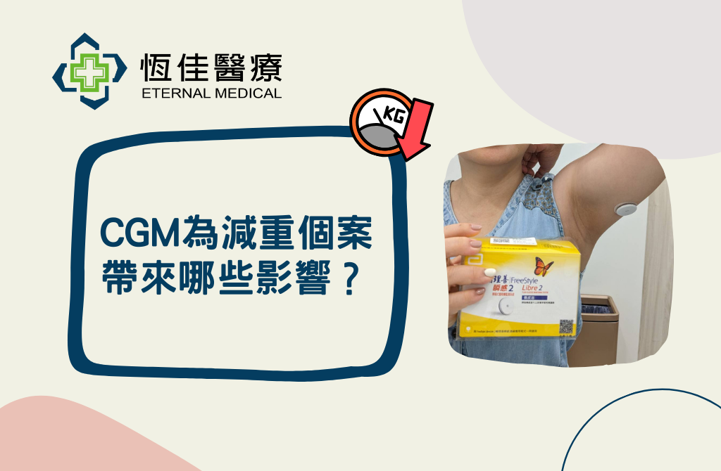 【 CGM為減重個案帶來哪些影響？】